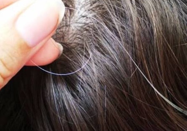 Μαλλιά ξηροδερμία στο κεφάλι τρόποι αντιμετώπισης