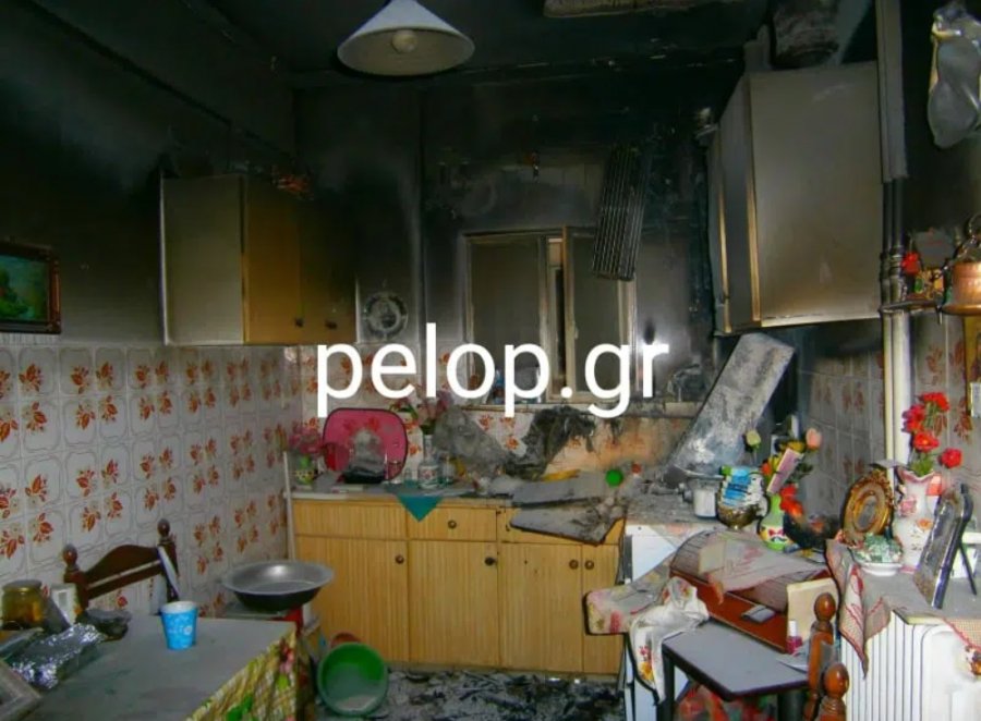 Πάτρα: Nεκρή γυναίκα από φωτιά που ξέσπασε στην κουζίνα – Τι συνέβη