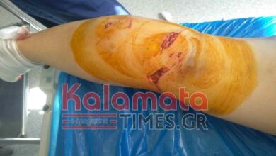 Καλαμάτα Επίθεση από αγέλη σκύλων