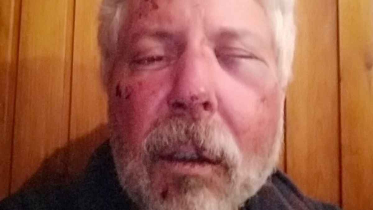 Αρκαδία: Εργολάβοι ξυλοκόπησαν άνδρα που κατήγγειλε παράνομο έργο τους